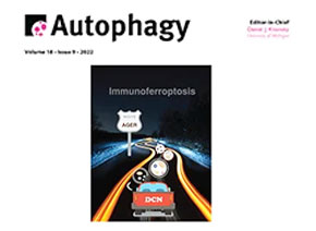 「輝駿客戶文章」Autophagy | 發(fā)現(xiàn)MIR516A在人類膀胱癌中的獨特作用