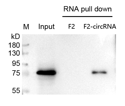 circRNA pull down wb檢測圖.jpg